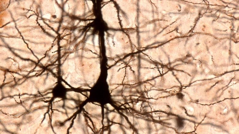 Нейроны в мозге