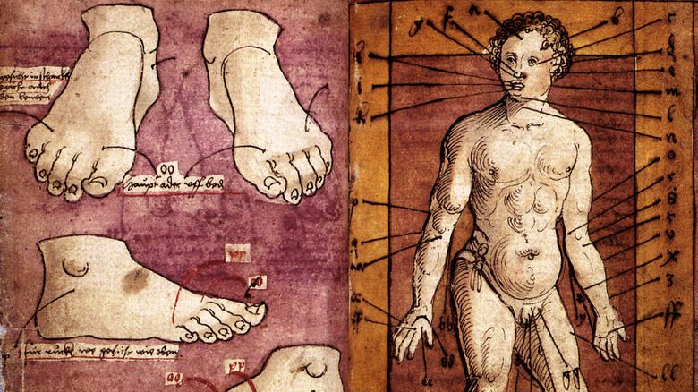  Кровопускание из немецкого медицинского манускрипта